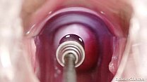 Examen y enema de la vagina de una rubia caliente
