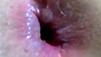 Its To Big Extreme Anal Sex With 8inchs Of Hard Dick Stretchs Ass