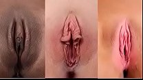 膣の種類と形