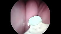 Caméra MILF rousse dans le col de l'utérus pour voir le sperme et le mur de son pussu